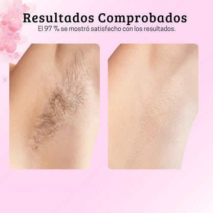 Cyperus Rotundus | El secreto egipcio para una piel suave y libre de vello