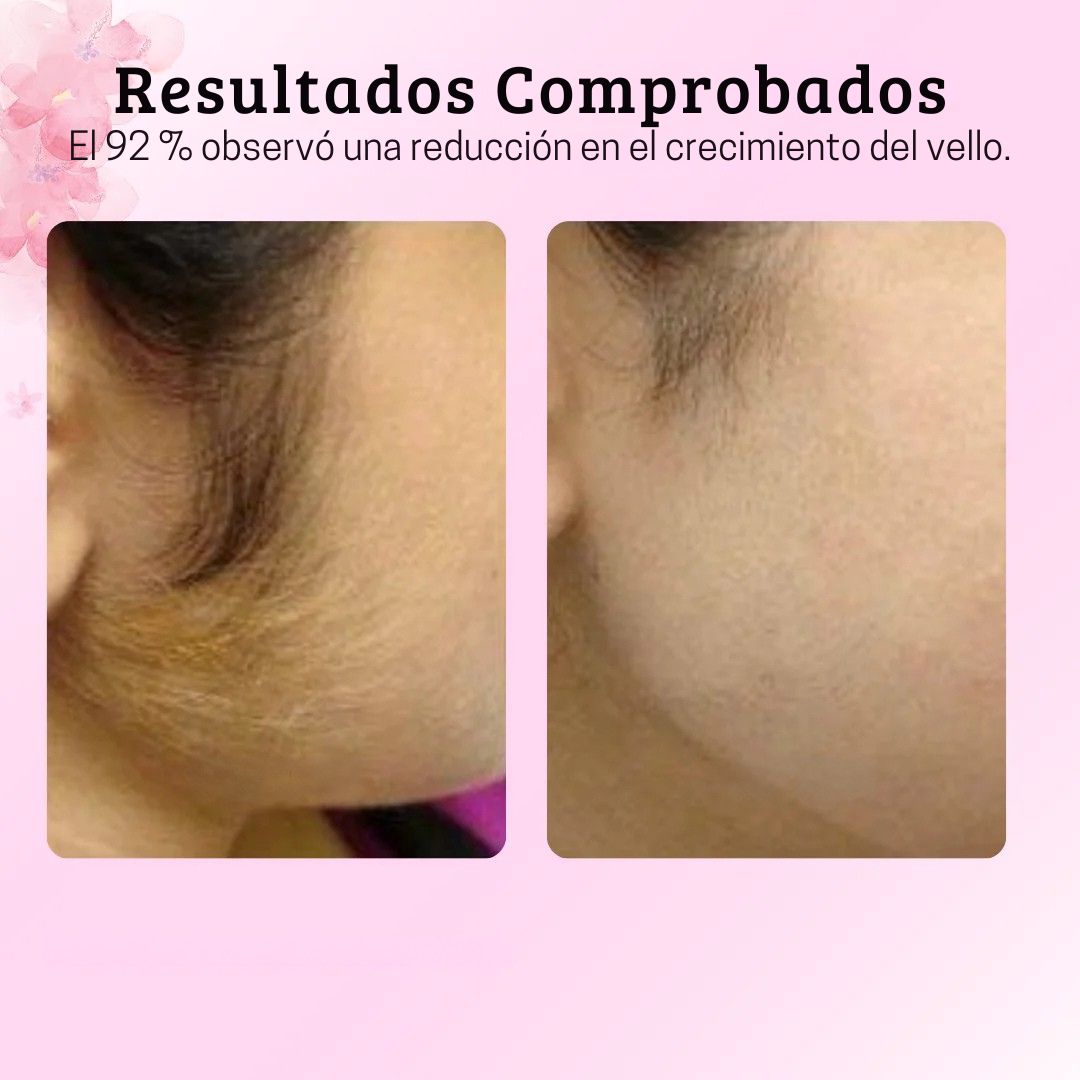 Cyperus Rotundus | El secreto egipcio para una piel suave y libre de vello