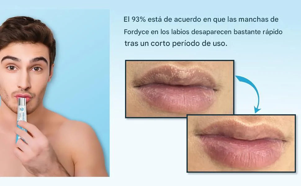 Recupera la suavidad y el tono natural de tus labios