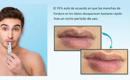 Recupera la suavidad y el tono natural de tus labios