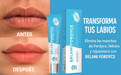 Recupera la suavidad y el tono natural de tus labios